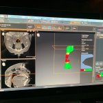 Photo of Dental X-Ray  {PRACTICE_NAME}